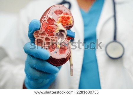 Chronic kidney disease, doctor holding model for treatment urinary system, urology, Estimated glomerular filtration rate eGFR. Royalty-Free Stock Photo #2281680735