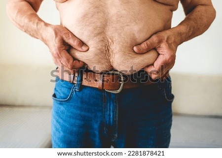 Overweight senior men holding his stomach. Man's stomach close up. Concept - overweight. A mature man holds his big belly in his hands. 