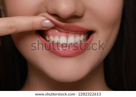 Young woman showing healthy gums, closeup view Royalty-Free Stock Photo #2282322613