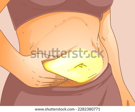 A woman's body with problem areas. Belly fat. Medical infographic. Healthcare illustration. Vector illustration.  Royalty-Free Stock Photo #2282380771