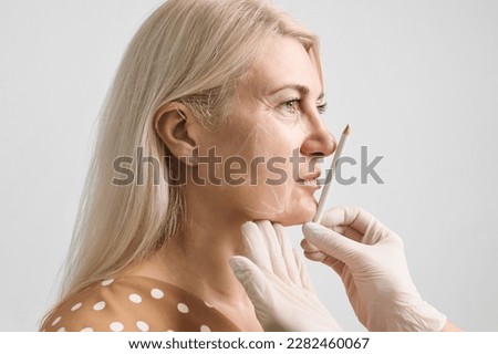 Thread facelift, concept of lifting skin. Procedure facial contouring using mesothreads. A beautician in gloves makes markings with a white pencil on a woman's face for the introduction of fillers Royalty-Free Stock Photo #2282460067
