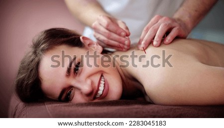 Dry Needle Acupuncture Treatment. Female Medical Spa Therapy Royalty-Free Stock Photo #2283045183