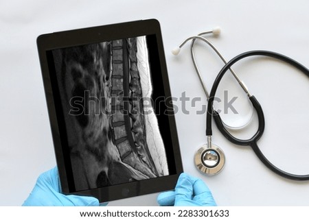Doctor, medical professional technician using a ipad tablet to view read MRI results