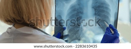 Doctor examines chest x-ray of patient in hospital. Pneumonia or bronchitis on medical pictures concept
