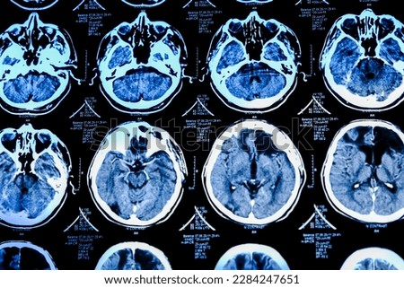 Close-up of CT scan with brain. Medicine, science and education MRI brain background. Magnetic resonance imaging. Tomography shot.