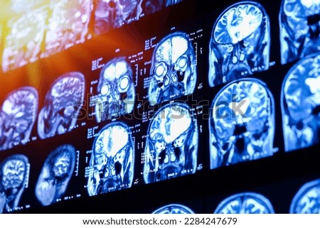 MRI scan of the brain for diagnosis. Medical examination for health prevention. Tomography shot. Close up of a CT scan with brain. Royalty-Free Stock Photo #2284247679