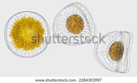 A marine phytoplankton, Campylodiscus sp. Marine diatom. Live cell. 40x objective lens. Selective focus Royalty-Free Stock Photo #2284303987
