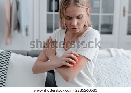 worried female feeling unwell, has allergy or reaction from insect bite, girl with itch or irritation on arm sitting on sofa in room  Royalty-Free Stock Photo #2285260583