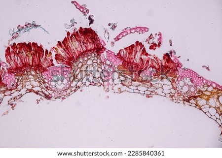 Host cells with spores (mold) are inside wood under the microscope for education.	 Royalty-Free Stock Photo #2285840361