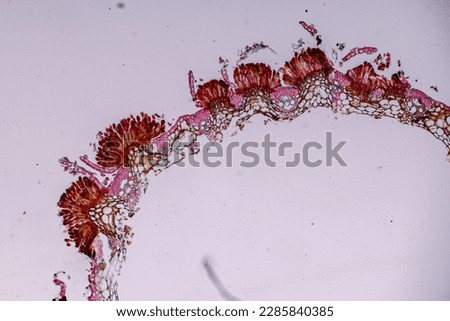 Host cells with spores (mold) are inside wood under the microscope for education.	 Royalty-Free Stock Photo #2285840385