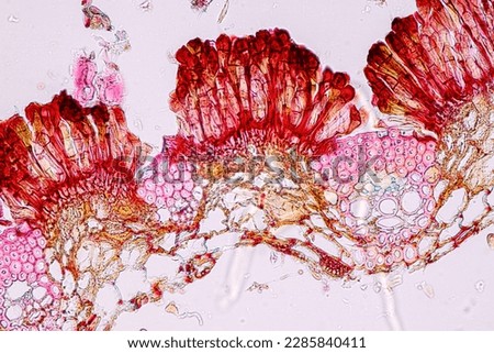 Host cells with spores (mold) are inside wood under the microscope for education.	 Royalty-Free Stock Photo #2285840411