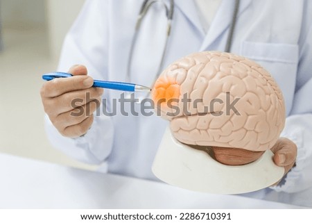 Neurologist hand pointing brain anatomy human model and brain disease lesion on white background.Part of human body model with organ system for health and doctor student study in university. Royalty-Free Stock Photo #2286710391
