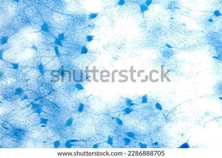 Motor neuron cells, whole mount, 8X light micrograph. Motoneurons under a light microscope. Motor neurous cells, also called efferent neurons, with axons, nerve fibers, that carry electrical signals. Royalty-Free Stock Photo #2286888705