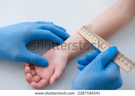 A nurse is doing an important Mantoux test on a child. The doctor measures the Mantoux test with a ruler for a little boy