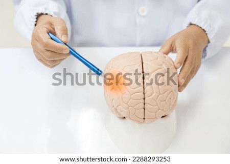 Neurologist hand pointing brain anatomy human model and brain disease lesion on white background.Part of human body model with organ system for health student study in university.Brain model. Royalty-Free Stock Photo #2288293253