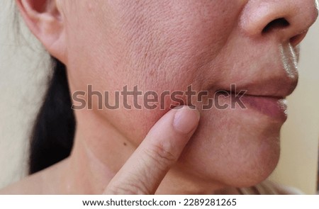 portrait the flabbiness and wrinkle  corner  of the mouth, smile lines and flabby skin beside the mouth , dark spots and dull skin, freckles and blemish on the face, health care and beauty concept. Royalty-Free Stock Photo #2289281265