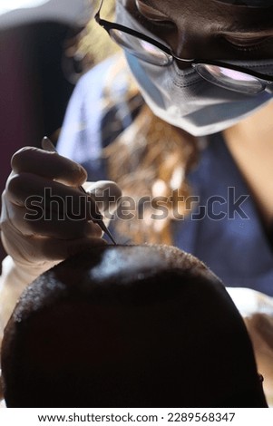 hair transplant dhi fue sapphire prp Royalty-Free Stock Photo #2289568347