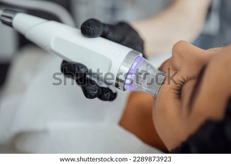 Microneedle RF lifting procedure. Hardware cosmetology. Beautician conducts a facial rejuvenation procedure for a brunette woman Royalty-Free Stock Photo #2289873923