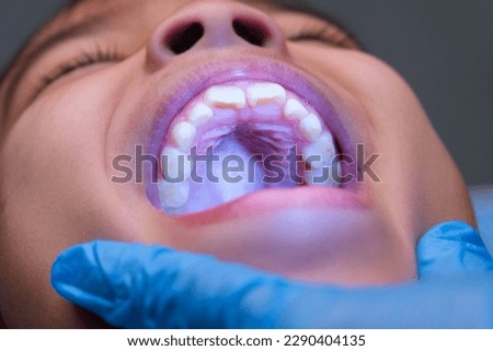 Close-up inside the oral cavity of a healthy child with beautiful rows of baby teeth. Young girl opens mouth revealing upper and lower teeth, hard palate, soft palate, dental and oral health checkup. Royalty-Free Stock Photo #2290404135