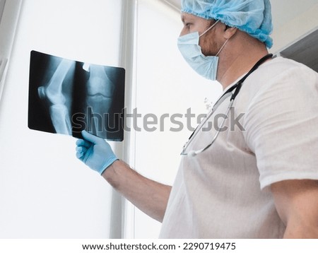 Doctor traumatologist analyzes a broken leg. X-ray of the knee. Leg injury in the knee joint. Osteoporosis Royalty-Free Stock Photo #2290719475