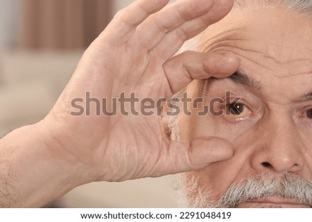 Senior man with yellow eyes on blurred background, closeup. Symptom of hepatitis