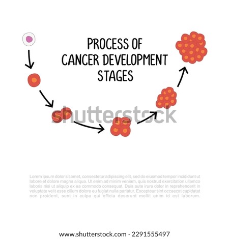 process of cancer development stages illustration isolated on white background.