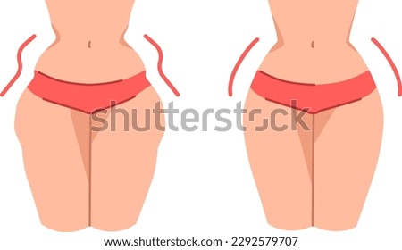 EPS10 vector illustration of hip dips before and after Royalty-Free Stock Photo #2292579707