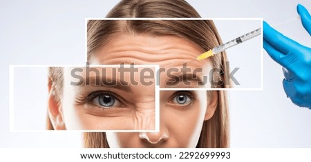Collage of anti-wrinkle injections on the face of a beautiful young girl. Women's cosmetology in a beauty salon. Royalty-Free Stock Photo #2292699993