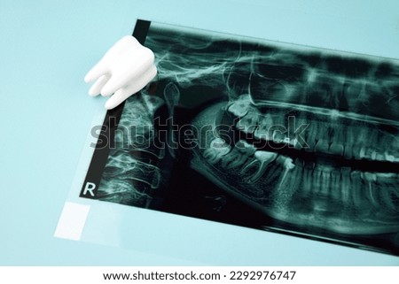 Panoramic snapshot of the jaw the patient's tooth on a light blue background.
