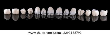 Emax ceramic crowns and veneers like natural teeth Royalty-Free Stock Photo #2293188793
