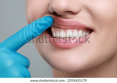 Doctor examining woman's gums on grey background, closeup Royalty-Free Stock Photo #2293435179