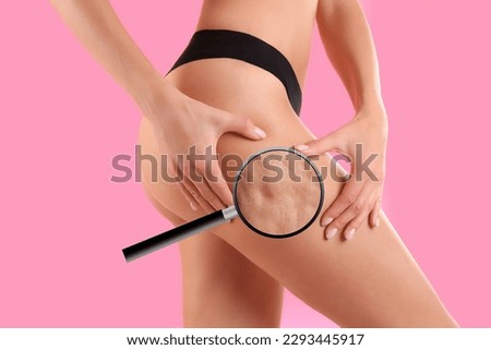 Cellulite problem. Slim woman in underwear on pink background, closeup. Zoomed skin with orange peel syndrome, view through magnifying glass Royalty-Free Stock Photo #2293445917
