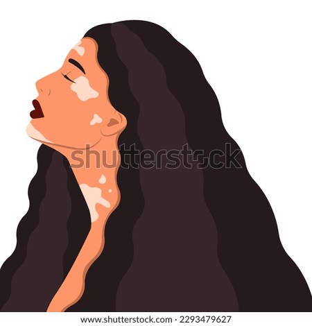 Beautiful woman with vitiligo on white background