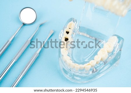 Healthy and decayed teeth model and mouth mirror, Dental concepts. Royalty-Free Stock Photo #2294546935