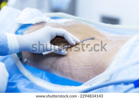 Surgeon or doctor use stainless medical probe to check the level of spine or vertebra before spinal surgery.Hand of people with glove on patient's back.Level checked by fluoroscopy.Operating room. Royalty-Free Stock Photo #2294834143