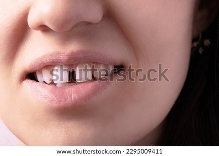 Close up of woman's open smiling mouth with gap teeht. Lips and unusual teeth. Royalty-Free Stock Photo #2295009411