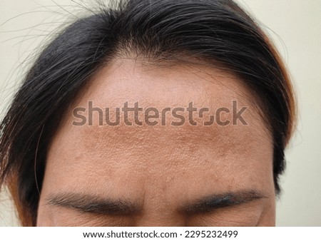 Forehead, Asian woman's face.The problem of freckles, dark spots and wrinkles on the faces of middle-aged women stressed expression, frowning, darkened face and face healthy concept. Royalty-Free Stock Photo #2295232499