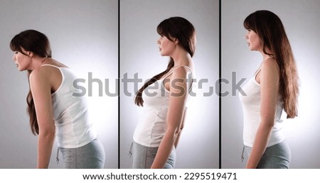 Head Forward Posture, Lordosis, Kyphosis And Scoliosis Royalty-Free Stock Photo #2295519471