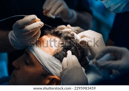 Hair Transplant Operation Process with Surgeon. Royalty-Free Stock Photo #2295983459