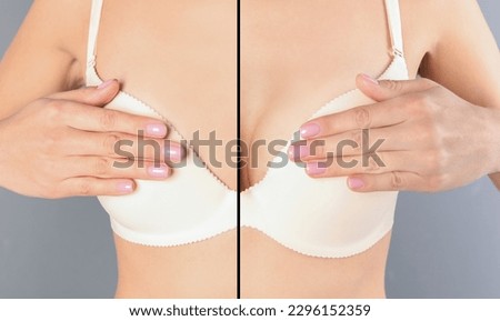 Breast augmentation with silicone implant. Photo of woman divided in halves before and after plastic surgery, collage on grey background