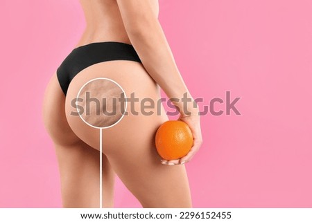 Cellulite problem. Slim woman in underwear holding orange on pink background, closeup. Zoomed skin with dimples Royalty-Free Stock Photo #2296152455