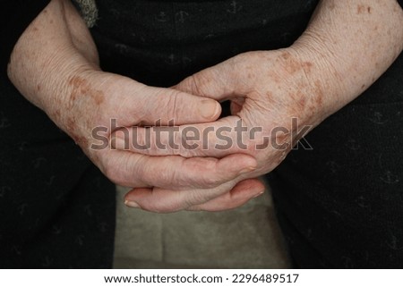 the hands of a very old woman with cracked skin and age spots Royalty-Free Stock Photo #2296489517