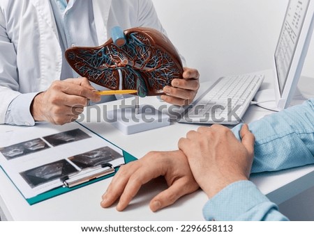 Human liver model on doctor's table, close-up. Treatment of hepatitis, cirrhosis and liver cancer Royalty-Free Stock Photo #2296658113