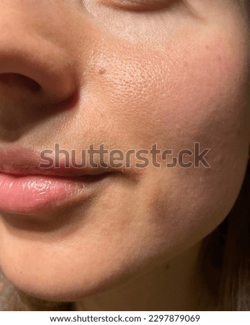 Macro photo of big pore on oily facial skin type. Skin with enlarged pores. Care for problem skin. Sun, natural light Royalty-Free Stock Photo #2297879069