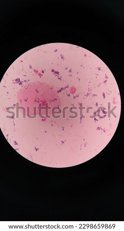 Squamous epithelial cells under microscope view Royalty-Free Stock Photo #2298659869