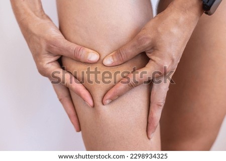 Stretch marks on female legs. A woman's hand holds a fat cellulite and a stretch mark on her leg. Cellulite.
