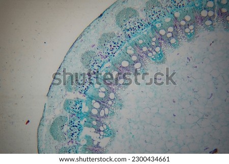 photo of a plant tissue under the microscope