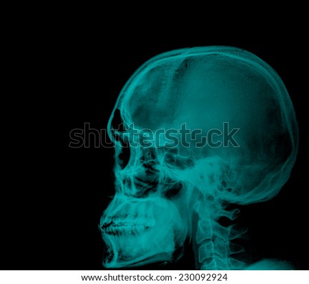 Human head x-ray film