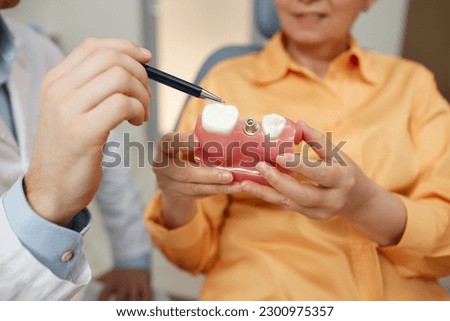 Closeup of unrecognizable dentist pointing at tooth model while explaining dental implant surgery to patient in clinic Royalty-Free Stock Photo #2300975357