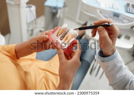 Close-up of unrecognizable senior woman holding tooth model during consultation on dental implant surgery in dental clinic Royalty-Free Stock Photo #2300975359